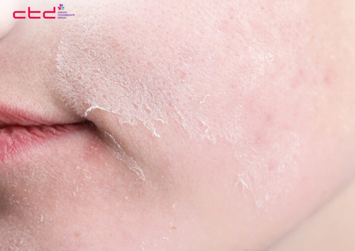 Skincare Tips for Dry Skin